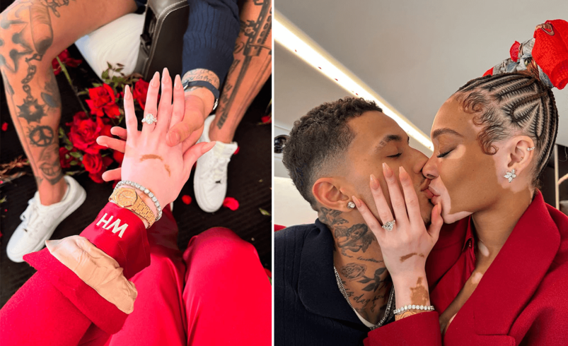 Winnie Harlow Engagement: Jaw-Dropping 8.5-Carat Ring from Kyle Kuzma – See the Stunning Proposal!