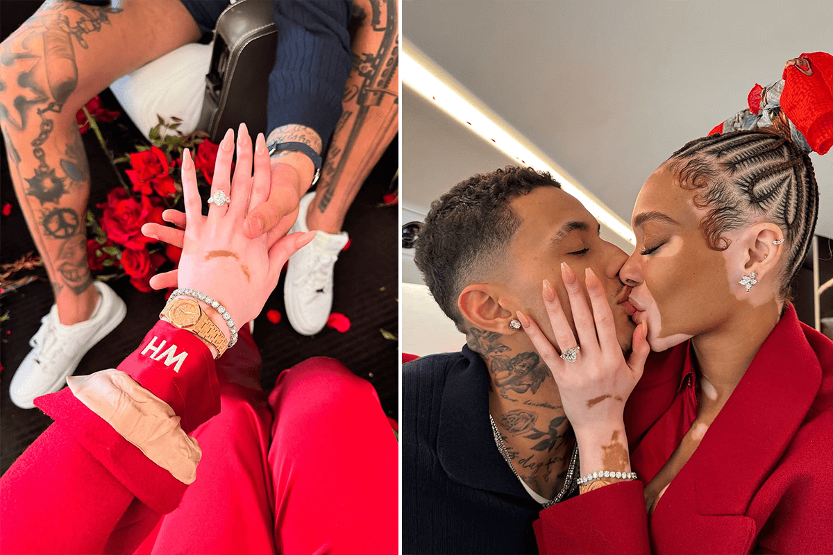 Winnie Harlow Engagement: Jaw-Dropping 8.5-Carat Ring from Kyle Kuzma – See the Stunning Proposal!